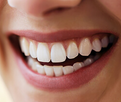 Closeup of smile with healthy teeth and gums