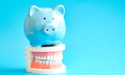blue piggy bank atop model teeth representing cost of dental implants in Coppell