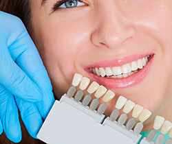 Closeup of smile compared to tooth color chart