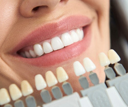 patient smiling next to shade scale