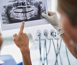 Patient and dentist examine X-ray before advanced dental implant procedures in Coppell