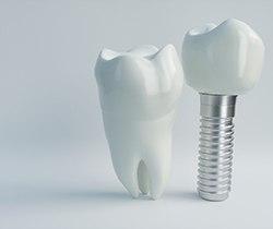 Dental implant in Coppell next to model tooth for comparison