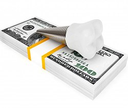 Model implant and money stack representing cost of dental implants in Coppell 