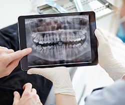 Patient and dentist reviewing X-ray together