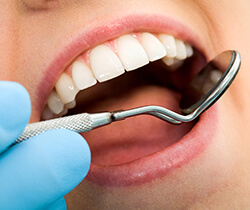 Closeup of smile during dental exam