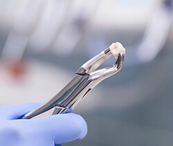 Forceps holding extracted tooth