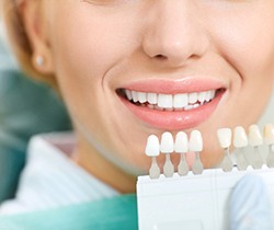 Dentist color matching veneers to woman’s natural teeth
