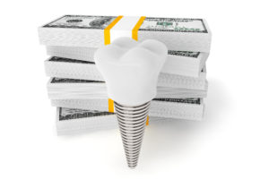 Dental implant with money in the background