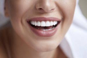 woman smiling with veneers  